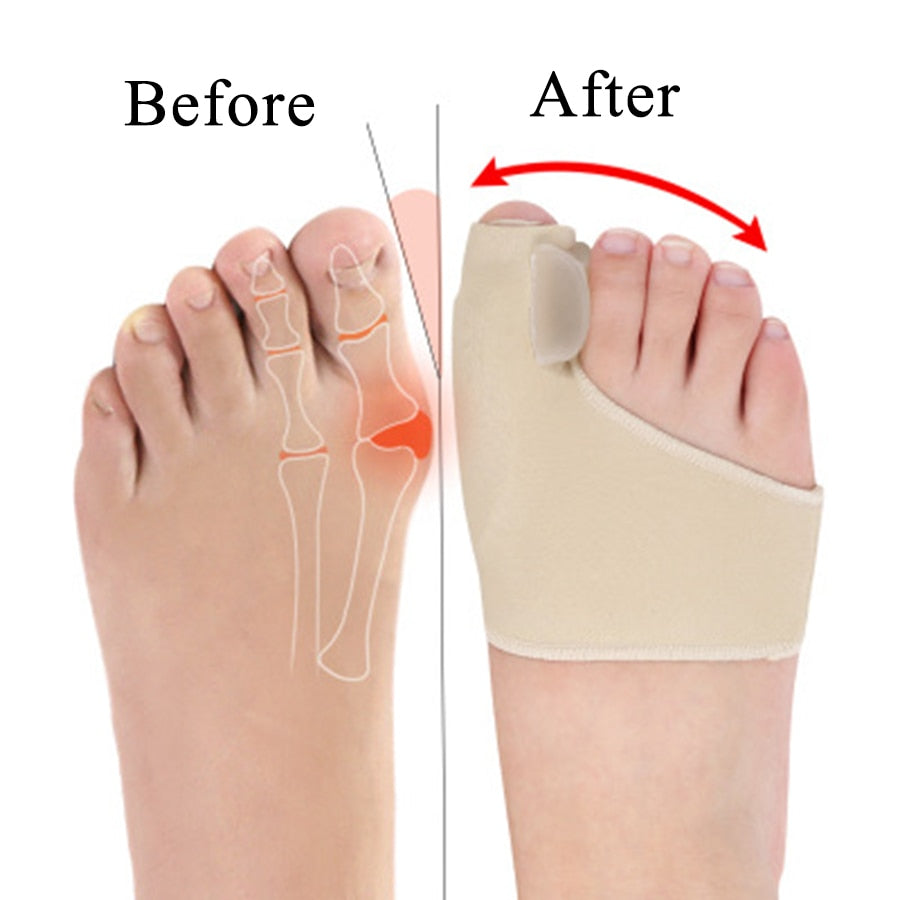 Bunion corrector Socks, Silicone Hallux Valgus Corrector Braces, Toes Separator insole